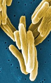 L'image de tuberculose